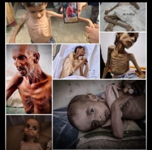 Gaza Starvation: A Slow Poison and a Lethal Path Towards Genocide